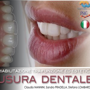 RIABILITAZIONE TRA FUNZIONE ED ESTETICA. USURA DENTALE