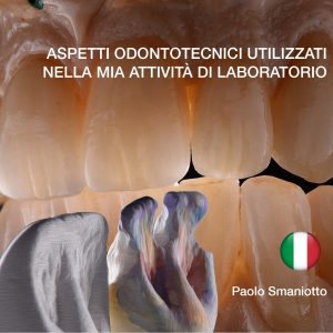ASPETTI ODONTOTECNICI UTILIZZATI NELLA MIA ATTIVITÀ DI LABORATORIO