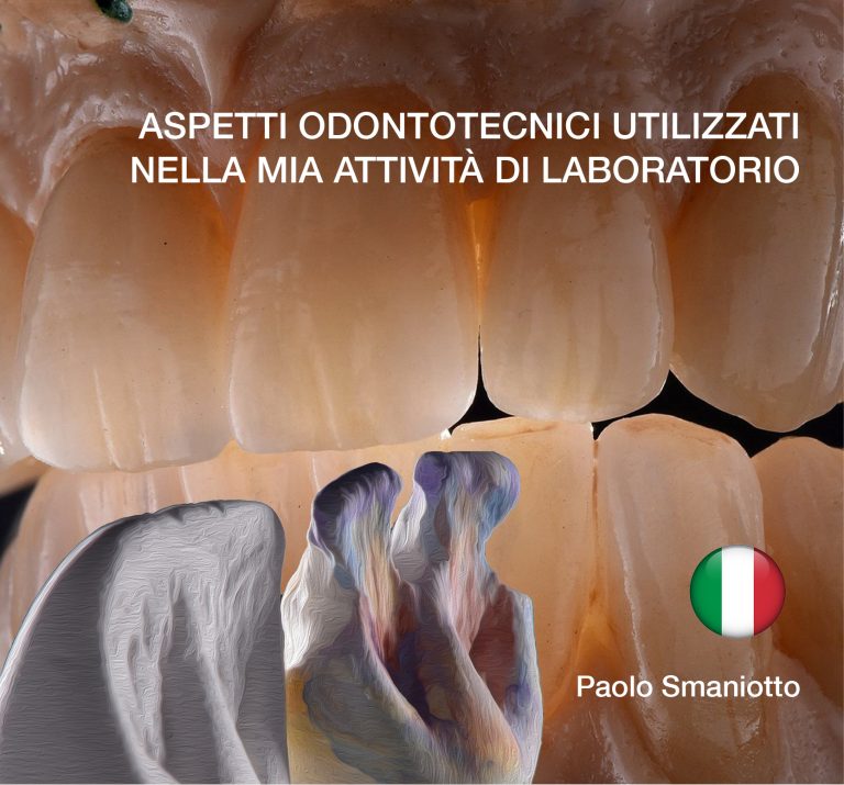 ASPETTI ODONTOTECNICI UTILIZZATI NELLA MIA ATTIVITÀ DI LABORATORIO