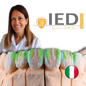 IED technique. Incisal Edge Design