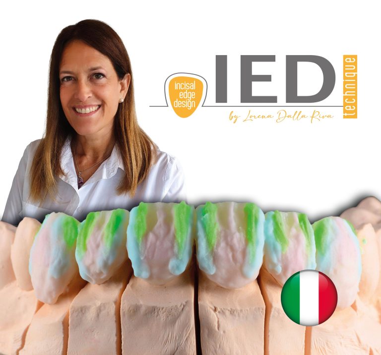 IED technique. Incisal Edge Design