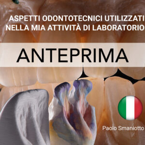 ASPETTI ODONTOTECNICI UTILIZZATI NELLA MIA ATTIVITÀ DI LABORATORIO