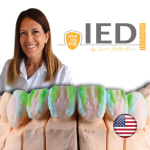 IED technique Incisal Edge Design