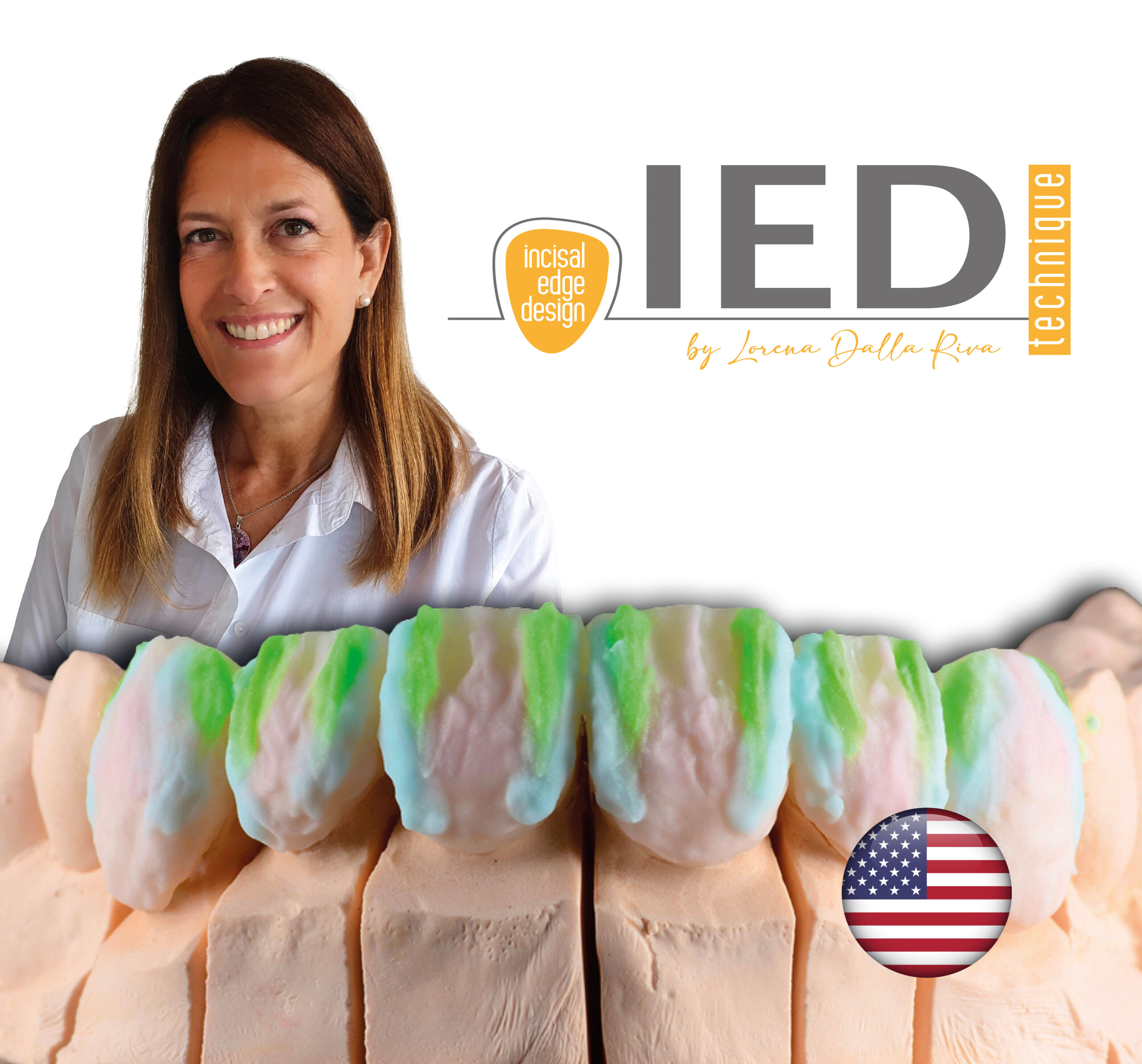 IED technique Incisal Edge Design