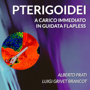 PTERIGOIDEI A CARICO IMMEDIATO IN GUIDATA FLAPLESS