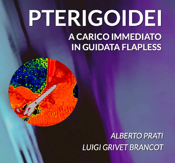 PTERIGOIDEI A CARICO IMMEDIATO IN GUIDATA FLAPLESS